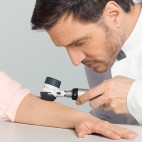 Dermatoscopes