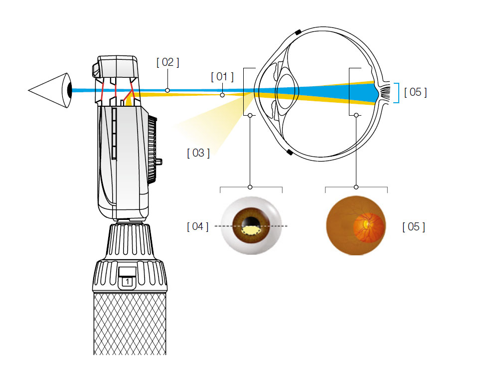 Aspheric optical system (AOS) from HEINE